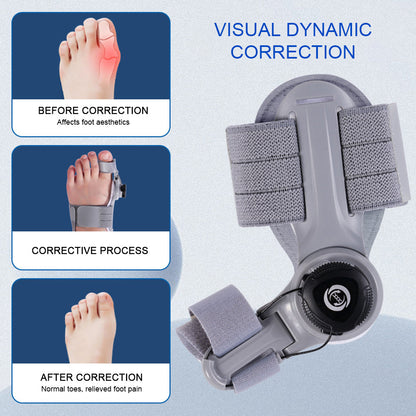 BunionFix™ - Natural At-Home Bunion Corrector